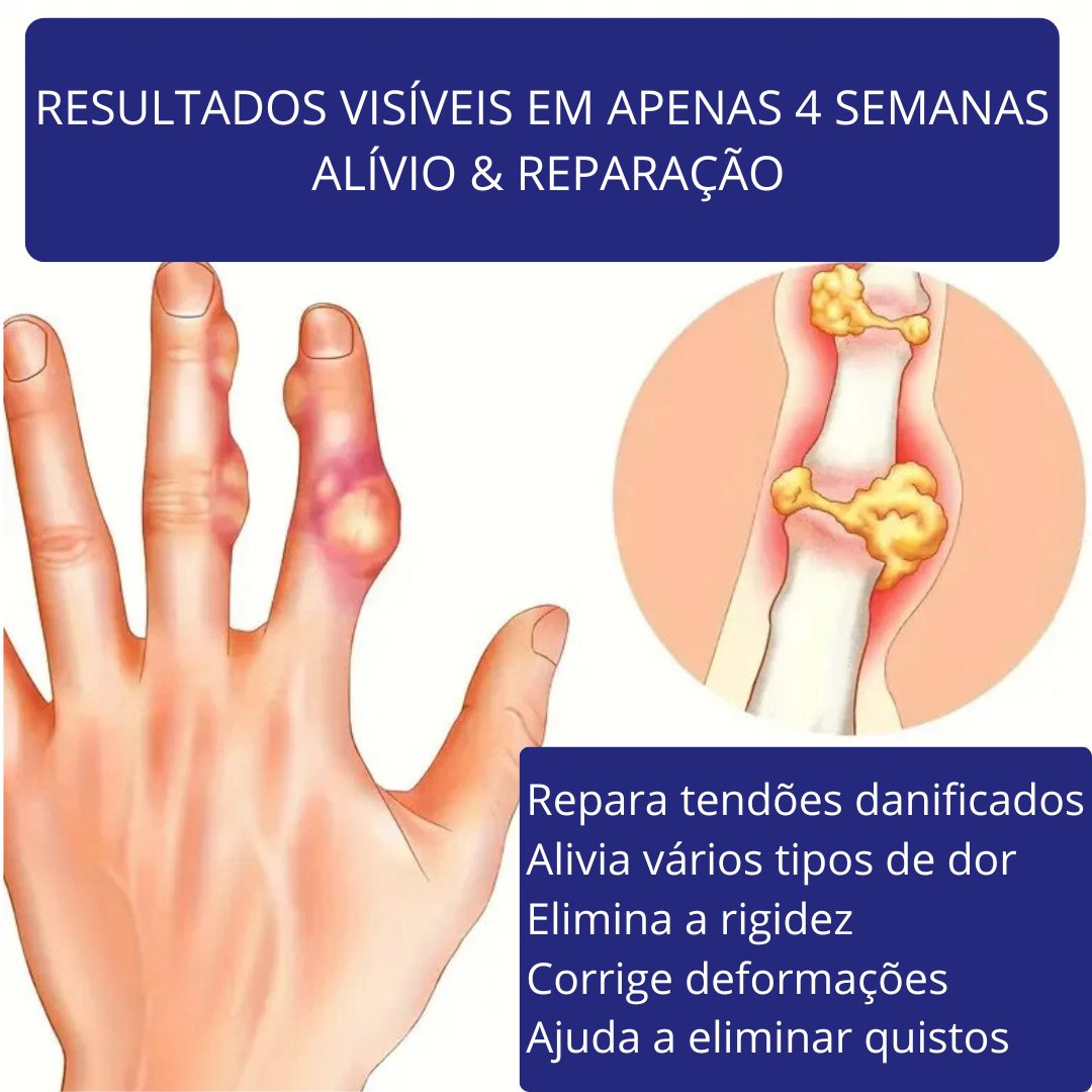 Pomada AlívioMel – Veneno de Abelha e Ingredientes Naturais